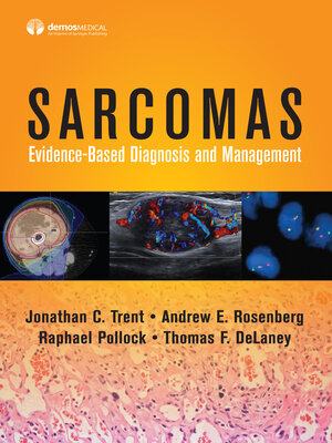 cover image of Sarcomas